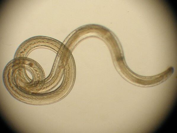 Trichinella en tant qu'espèce de parasite humain