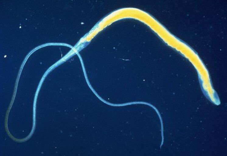 Le trichocéphale est un parasite intestinal commun.