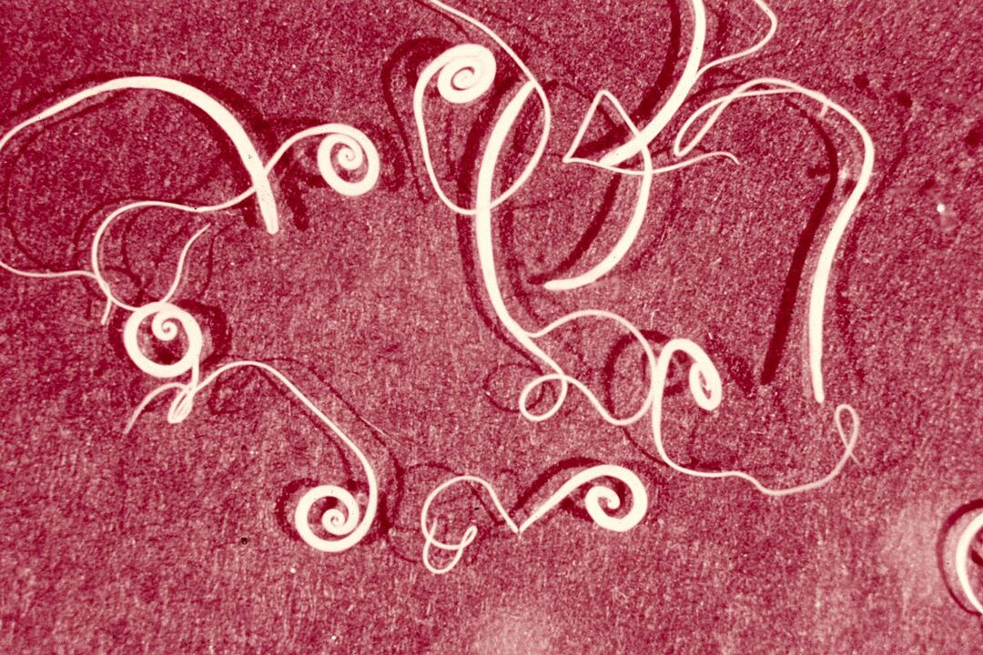 vers humains de trichinella