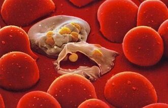 paludisme plasmodium dans le corps humain